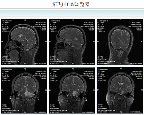 DICOM浏览器