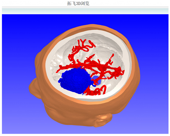 3D浏览器
