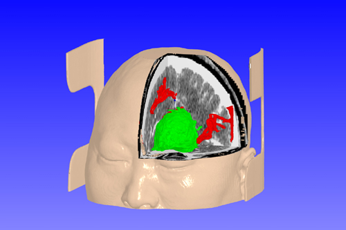 portfolio-thumb-4